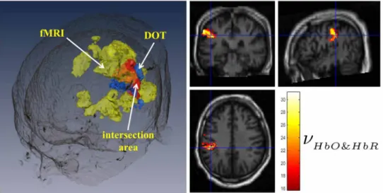 Fig. 9. Activation maps obtained from the right finger tapping task (Subject 3). MUSIC spectrum of DOT is based on combination of HbO and HbR, in which df = 1, q-level for FDR control is given as 0.01