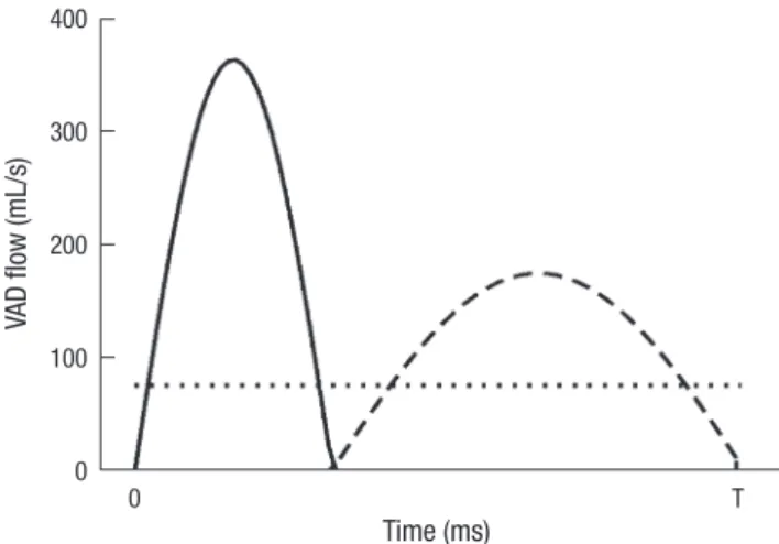 Fig. 2. Flow waveforms of pulsatile and continuous LVADs. LVAD flow waveforms  during one cycle (T; 860 milliseconds) in continuous and pulsatile LVADs