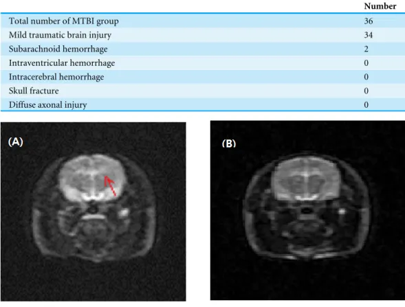 Table 1 Anatomical change after the mild traumatic brain injury (MTBI).