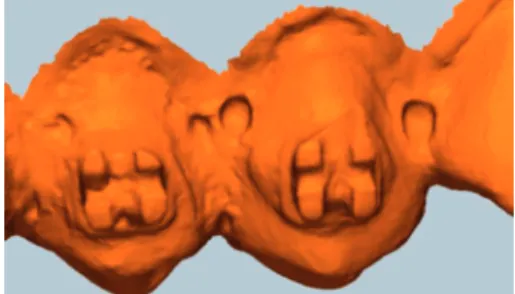 Figure 6: Bubbles formed on the surface of study models; the image captured on Geomagic Verify ™ before superimposition
