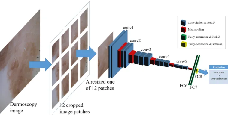 Fig 2. Schematic overview of our CNN architecture: The number of output classes was set to 2 (melanoma and non-melanoma classes) for the dermoscopic images.