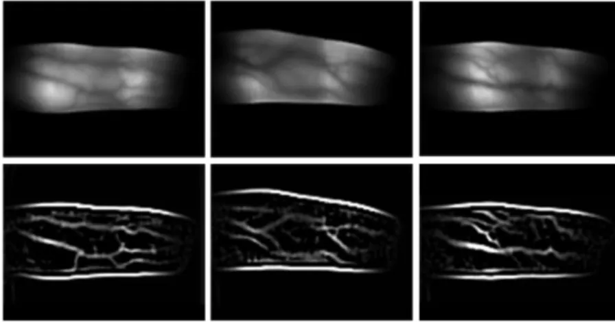 Figure 5. Down-sampled finger images (top) and their filtered results. 