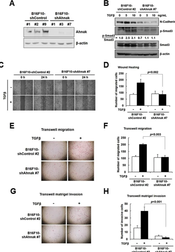 Figure 4.  Ahnak regulates EMT-mediated melanoma cell migration and invasion. (A) B16F10 melanoma cells 