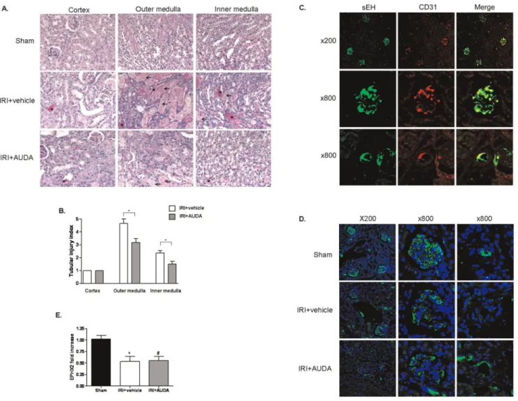 Figure 2. Effects of 12-(3-adamantan-1-ylureido)-dodecanoic acid (AUDA) on renal expression of soluble epoxide hydrolase (sEH) in ischemia-reperfusion injury (IRI) in kidneys