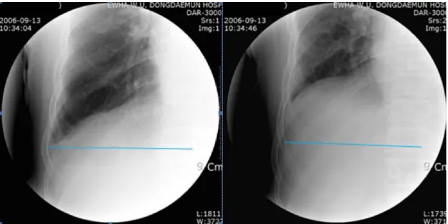 Table 3 exhibits changes in pulmonary functions in COPD  patients  between  pre-  and  postpulmonary  rehabilitation  programs