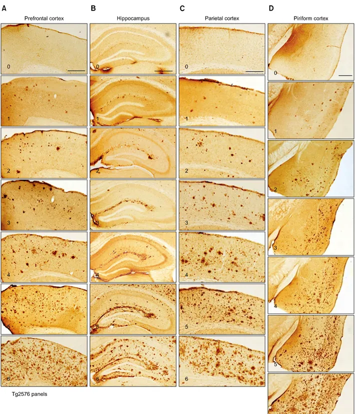 Figure 1.  Photomicrographs showing the 6-grade photographic plaque reference panels for four selected regions in the brains of Tg2576 mice (plate A or 