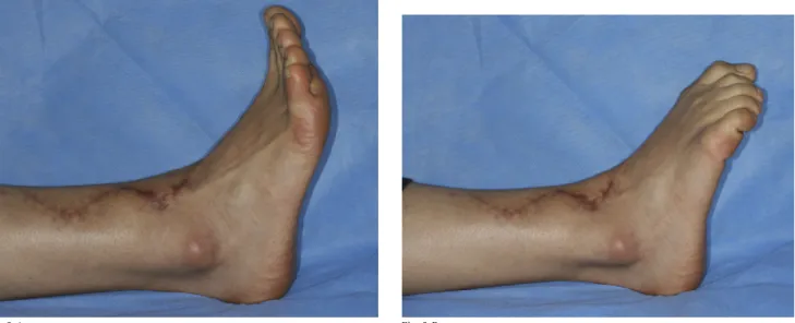 Fig. 5-A Fig. 5-B