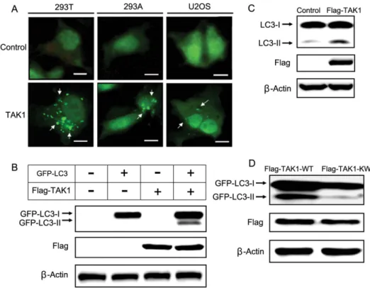 Figure 2 | TAK1 overexpression induces autophagy in several cell types. (A) GFP-LC3 was co-transfected with a control plasmid or a TAK1 plasmid