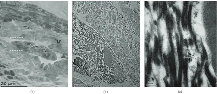Figure 4: Transmission electron microscopic image of cross sections of a novel threadlike structure (NTS) within a rabbit lymphatic vessel