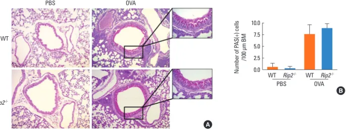 Fig. 2.  Hyperplasia of goblet cells and mucus hypersecretion in the bronchus of lung tissue