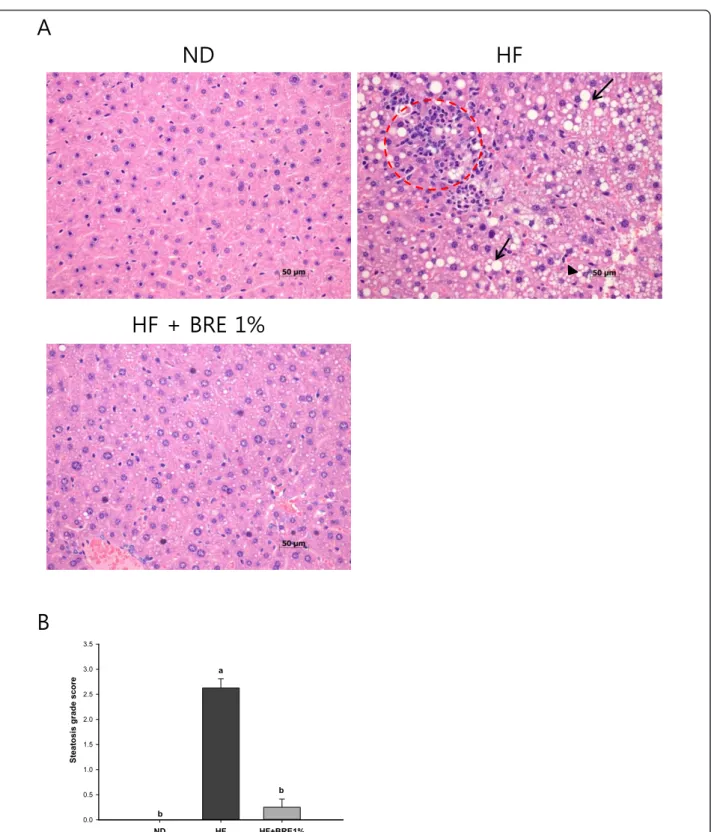 Figure 4 Effect of BRE supplementation on liver histology. Photomicrographs of H&amp;E stained longitudinal liver sections from representative animals in the ND, HF, and HF + BRE1% groups (magnification 400×) (A)