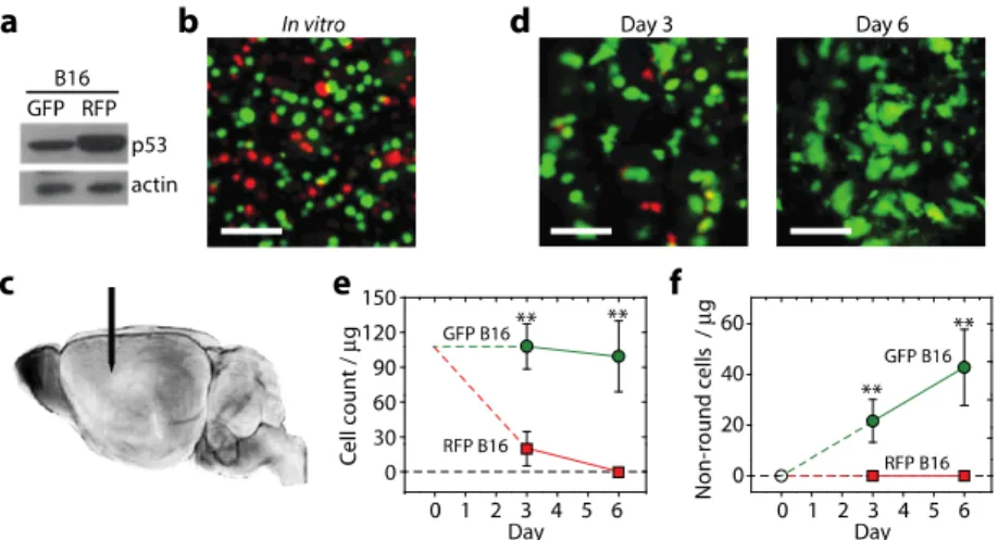 Fig. 4. Assessing the brain metastasis of melanoma cells. (a) Western blots showing the normal  and overexpression levels of p53 for the GFP + and RFP + B16 melanoma cells, respectively