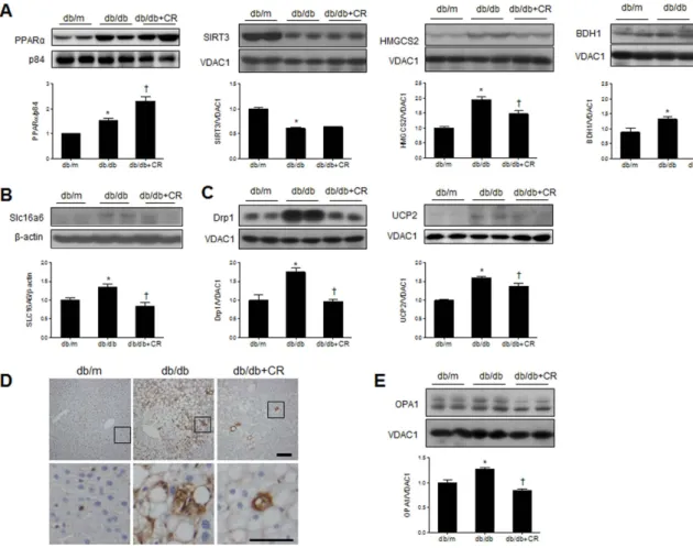 Figure 5.  Effects of caloric restriction (CR) on ketogenesis and mitochondrial dysfunction in the livers of db/ db mice