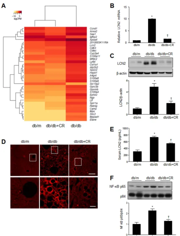 Figure 6.  Effects of caloric restriction (CR) on inflammation in the livers of db/db mice