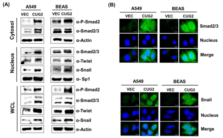 Figure 3: Overexpression of CUG2 activates TGF-β signaling.  A. Expression of phospho-Smad2, Smad2/3, Snail and Twist in  A549-CUG2 and BEAS-CUG2 cells was compared with those in their control cells by immunoblotting