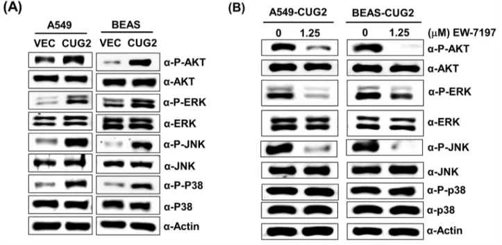 Figure 7: CUG2 activates Akt and MAPKs, which are dependent on TGF-β signaling, except p38 MAPK