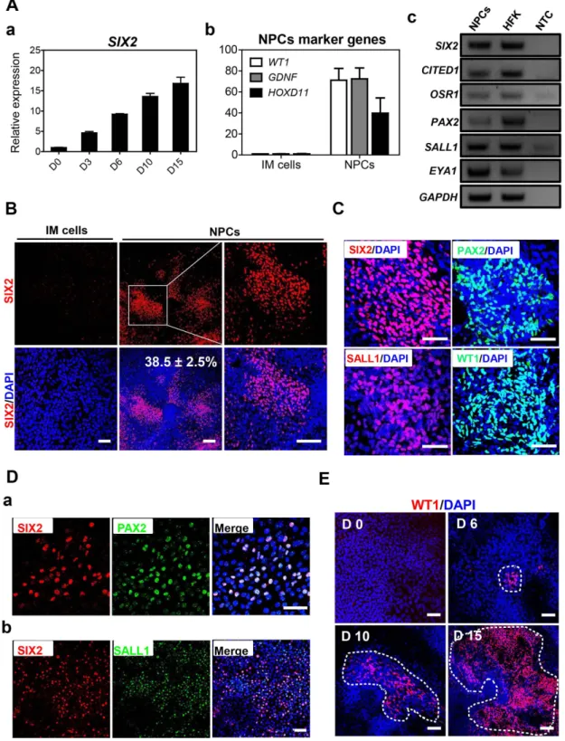 Figure 4. Differentiation of hESC-derived IM cells into NPCs. A. (a) Time course of the transcriptional expression of key NPCs marker SIX2 in hESC-derived NPCs