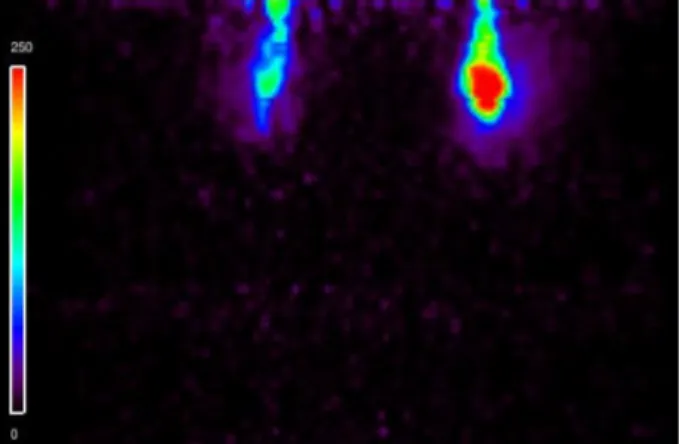Figure 4. Animal PET image of a mouse having an acute inflammation  on the right foot