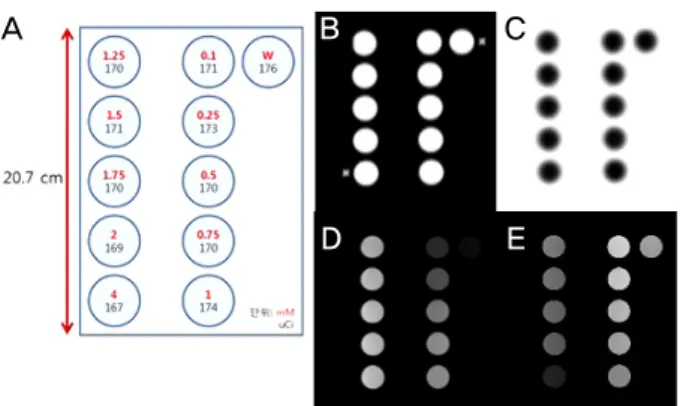 Figure 1. Phantom images used in the evaluation of relationship be- be-tween MR contrast and CT values (A) design of phantom, (B) CT image,  (C) PET image, (D) MR T1 images  and (E) MR T2 image.