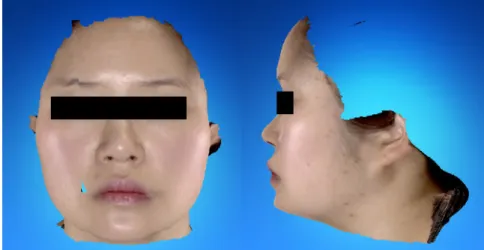Figure 2. Anterior view and lateral view of face scanned by 3D Facial Scanner (RFS-S100) (APR-3-2014) 10