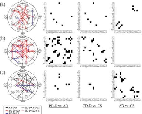 Figure 3. Connections with significant differences between the two patient groups for each band