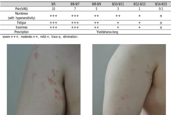 Figure  1.  Picture  of  vesicles(9/5)  Figure  2.  The  change  of  vesicles(9/15)