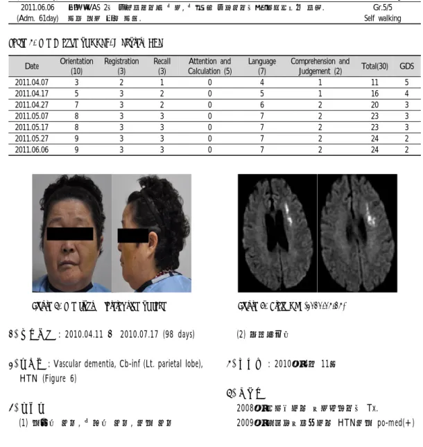 Figure  5.  The  front  &amp;  lateral  side  of  face Figure  6.  Brain  MRI  (2010.04.14) 2) 치료기간 : 2010.04.11 ～  2010.07.17 (98 days)