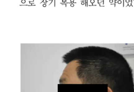Fig.  1.  Frontal  view  of  face  Fig.  2.  Lateral  view  of  face서도 또렷하고 콧대는 예리하며 비익도 날렵한편