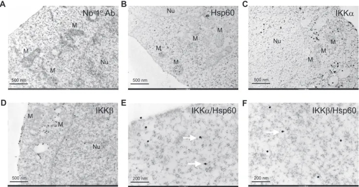 Figure 2. Visualization of Hsp60 and IKK interaction at a single-cell level. HeLa cells were immunoreacted with no primary (A), anti-Hsp60 (B), anti-IKKa (C), anti-IKKb (D), anti-Hsp60/IKKa (E), and anti-Hsp60/IKKb (F) antibodies, and then labeled with the
