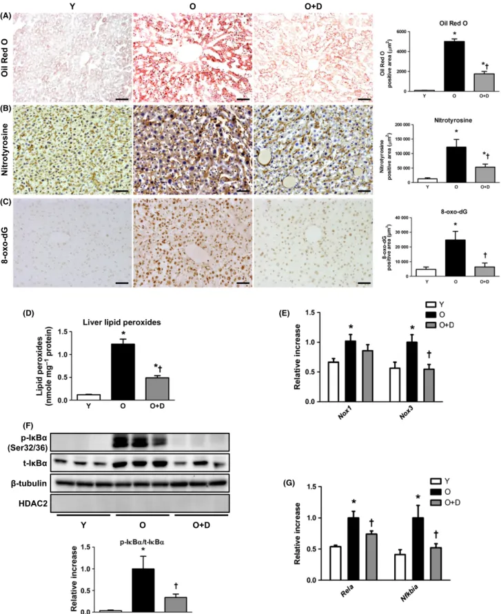 Fig. 4 Effects of daumone on hepatic lipid accumulation and oxidative stress in aged mice