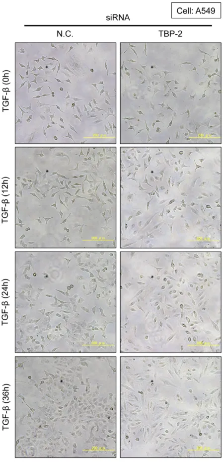 Figure 5. Knockdown of TBP-2 accelerates TGF-b-induced cell morphological changes. A549 cells transfected with TBP-2-targeting siRNA (TBP-2) or negative control siRNA (N.C.) were cultured in the presence of TGF-b (2.5 ng/ml) for 0, 12, 24 and 36 hours
