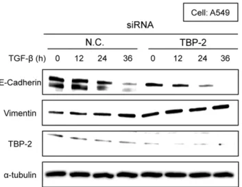 Figure 6. Knockdown of TBP-2 accelerates TGF-b-driven E- E-Cadherin degradation. A549 cells transfected with TBP-2-targeting siRNA (TBP-2) or negative control siRNA (N.C.) were treated with TGF-b (2.5 ng/ml) for 0, 12, 24 and 36 hours