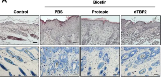 Figure 1. Dimerized translationally controlled tumor protein-binding peptide 2 (dTBP2) ameliorates house dust mite-induced atopic dermatitis (AD)-like skin lesions and lymph node in Nishiki-nezumi Cinnamon/Nagoya (NC/Nga) mice
