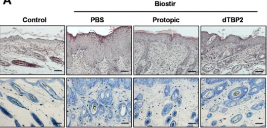 Figure 1. Dimerized translationally controlled tumor protein-binding peptide 2 (dTBP2) ameliorates house dust mite-induced atopic dermatitis (AD)-like skin lesions and lymph node in Nishiki-nezumi Cinnamon/Nagoya (NC/Nga) mice