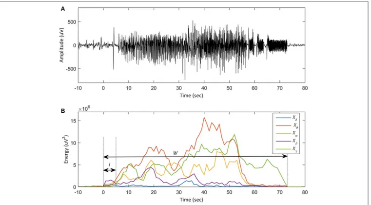 FIGURE 2 | Plot of an ictal EEG in training set and each subband energy. (A) Plot of the ictal EEG, seizure No