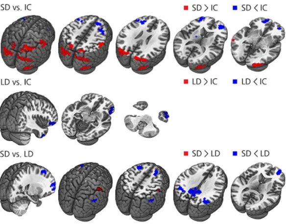 Figure 3.  Correlation graph between the duration of parkinsonism before MCI diagnosis and rsFC between 