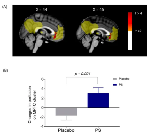 Figure 4. (A) Changes in cerebral perfusion on the default mode network (DMN) between the PS and placebo group