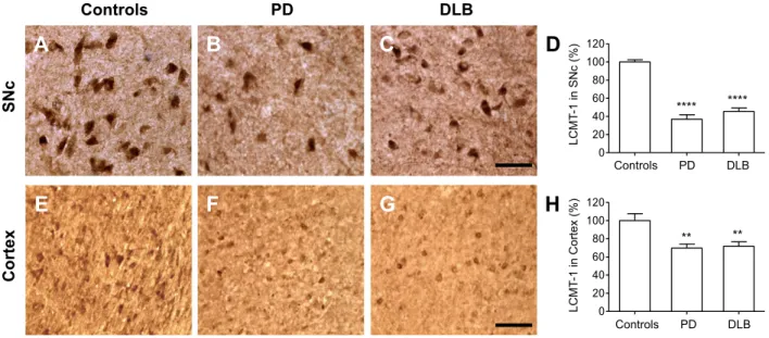 Figure 1. Comparison of LCMT-1 expression in Parkinson disease (PD), dementia with Lewy bodies (DLB), and Control brains