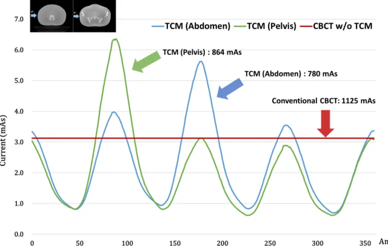 Fig 8 shows a conventional CBCT image and TCM image of an ATOM abdominal region