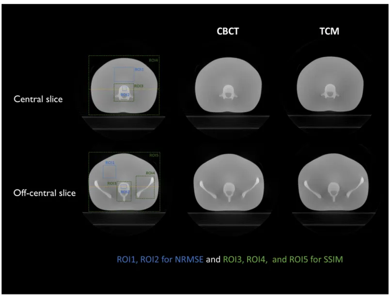 Table 3 shows that NRMSE values of the TCM exhibited little difference when compared with those of the CBCT