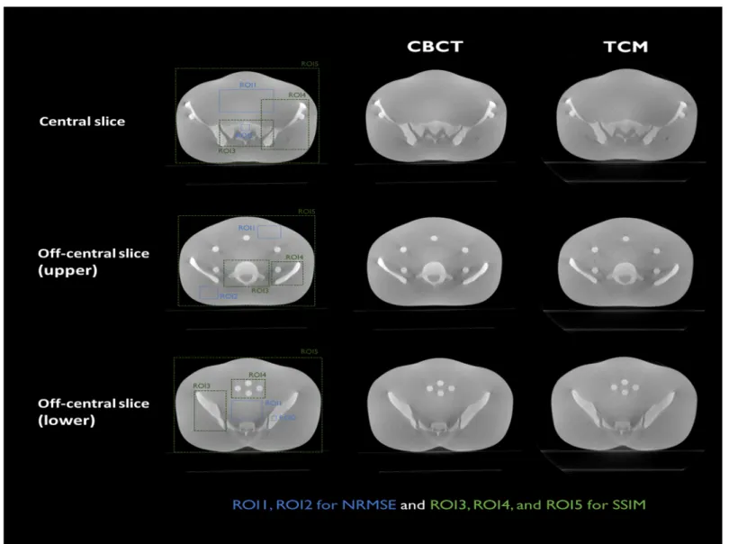 Table 3. NRMSE and SSIM calculated for central and off-center slices. ROIs are defined in Fig 10 .