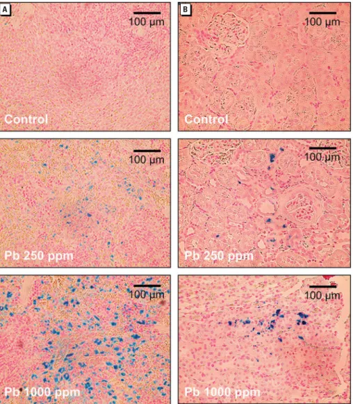 Figure 3. Representative photomicrographs showing the accumulation of iron in the spleen ( A) and  kidney (B) from rats treated with Pb 2+  in drinking water [0 (control), 250, or 1,000 ppm] for 12 weeks
