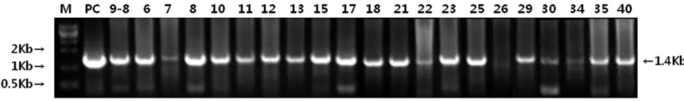 Figure 1. RT-PCR analysis of infected HEp-2 cell lysates. Agarose gel electrophoresis of RT-PCR products was performed to detect G gene