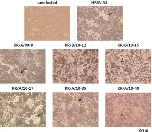 Figure 4. Morphological characteristics of HEp-2 cells infected by HRSV isolates. Cytopathic effects of HRSV isolates were observed 3,5 days after infecting HEp-2 cells