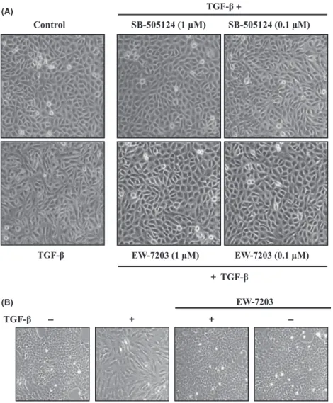 Fig. 3. Effect of EW-7203 on transforming growth factor-b type I (TGF-b1)-induced morphological changes