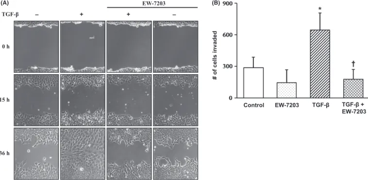 Fig. 5. Inhibition of transforming growth factor-b type I (TGF-b1)-induced cell motility by EW-7203