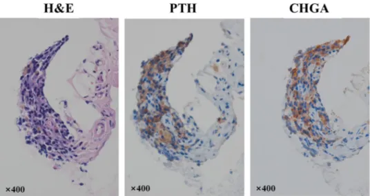 Figure 5.  Histological evaluation of transplanted tonsil-derived stem cells with plasma gel