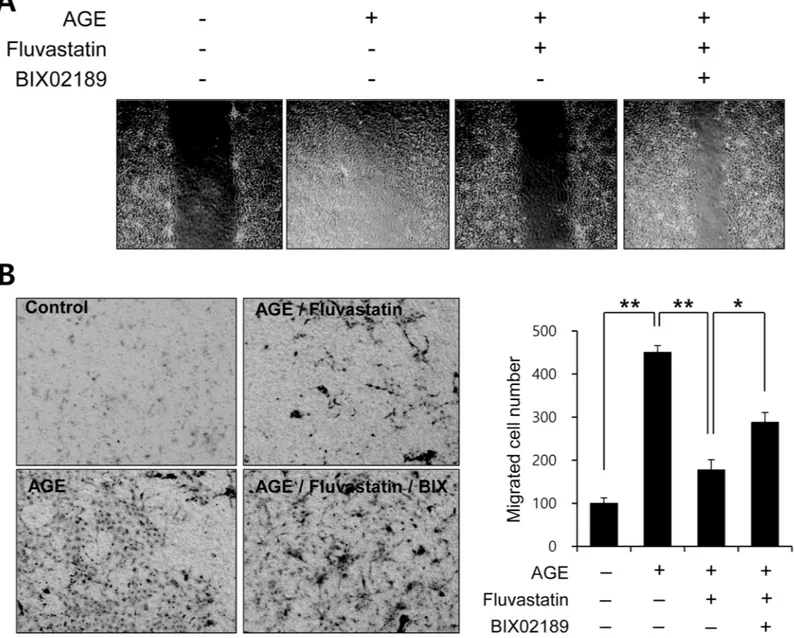 Fig 7. Fluvastatin regulated AGE-induced cell migration through an ERK5-dependent pathway in VSMCs
