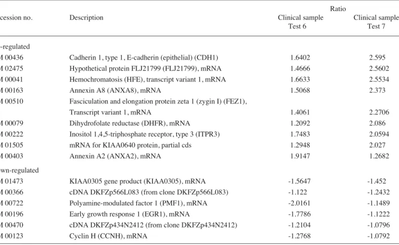 Table III. Up- and down-regulated genes after chemotherapy in GPG patients.