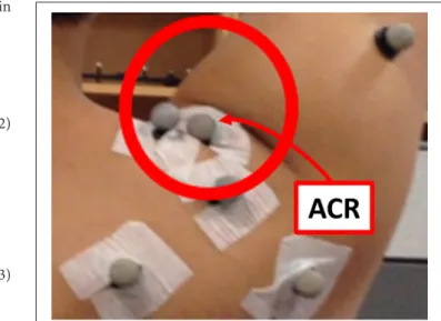 FIGURE 5 | Skin folding observed during the pilot study. The position of the ACR marker was affected significantly by the skin motion.